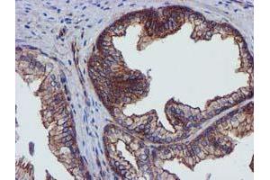 Image no. 3 for anti-Epsin 2 (EPN2) antibody (ABIN1498050)