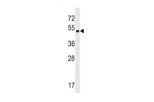 Western blot analysis in A2058 cell line lysates (35ug/lane). (ZNF559 anticorps  (AA 196-224))