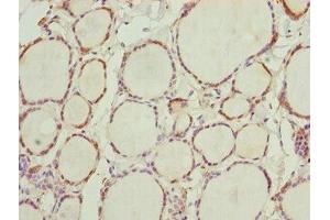 Immunohistochemistry of paraffin-embedded human thyroid tissue using ABIN7161775 at dilution of 1:100