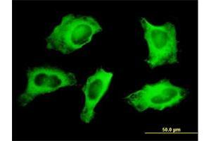 Immunofluorescence of monoclonal antibody to MYH9 on HeLa cell. (Myosin 9 anticorps  (AA 131-220))
