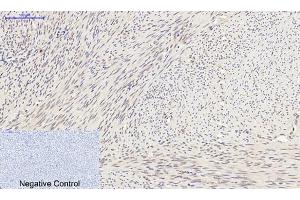 Immunohistochemical analysis of paraffin-embedded human uterus tissue.