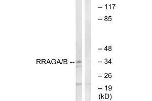 Western blot analysis of extracts from HepG2 cells, using RRAGA/B antibody.
