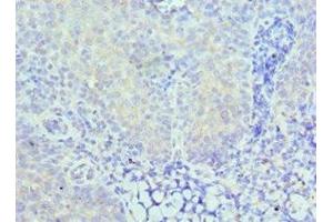 Immunohistochemistry of paraffin-embedded human tonsil tissue using ABIN7146923 at dilution of 1:100 (CARD8 anticorps  (AA 1-200))