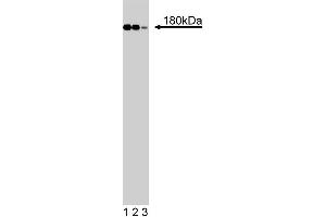 Western blot analysis of IRS-1 on RSV-3T3 cell lysate.