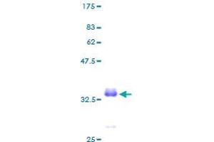 SDS-PAGE (SDS) image for Purkinje Cell Protein 4 (PCP4) (AA 1-62) protein (GST tag) (ABIN1314344)