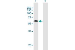 Western Blot analysis of MON1B expression in transfected 293T cell line by MON1B MaxPab polyclonal antibody. (MON1B anticorps  (AA 1-547))