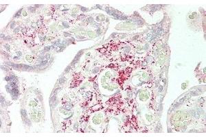 Detection of Slit2 in Human Placenta Tissue using Polyclonal Antibody to Slit Homolog 2 (Slit2) (SLIT2 anticorps  (AA 1160-1333))