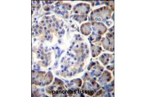 SMAP2 Antibody immunohistochemistry analysis in formalin fixed and paraffin embedded human pancreas tissue followed by peroxidase conjugation of the secondary antibody and DAB staining. (SMAP2 anticorps  (AA 111-140))