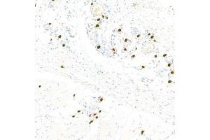 Immunohistochemistry analysis of paraffin-embedded rat skinusing Chymase (ABIN7073506) at dilution of 1:1000 (CMA1 anticorps)