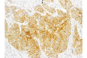 anti-Insulin Receptor beta (ISR-beta) (C-Term) antibody