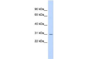 WB Suggested Anti-NFKBIA Antibody Titration:  0.