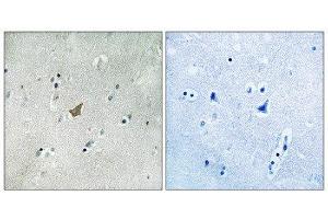 Immunohistochemistry (IHC) image for anti-EPH Receptor A3 (EPHA3) (pTyr779), (pTyr833) antibody (ABIN1847592) (EPH Receptor A3 anticorps  (pTyr779, pTyr833))