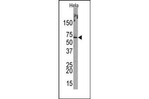 Image no. 1 for anti-Promyelocytic Leukemia (PML) (Sumoylation Site) antibody (ABIN357734) (PML anticorps  (Sumoylation Site))