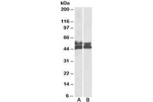 Western blot testing of human tonsil [A] and thymus [B] lysates with FCRL1 antibody at 0. (FCRL1 anticorps)