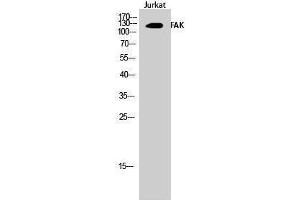 Western Blotting (WB) image for anti-PTK2 Protein tyrosine Kinase 2 (PTK2) (Thr446) antibody (ABIN3184583) (FAK anticorps  (Thr446))