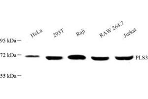 Western blot analysis of PLS3 (ABIN7075097) at dilution of 1: 500 (Plastin 3 anticorps)