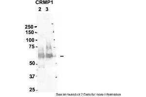 Sample Type: 2. (CRMP1 anticorps  (N-Term))