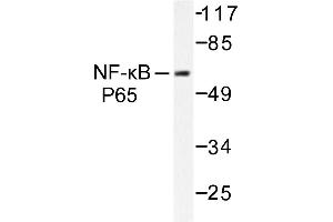 Image no. 1 for anti-Nuclear Factor-kB p65 (NFkBP65) antibody (ABIN271749) (NF-kB p65 anticorps)