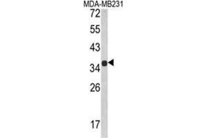 Western blot analysis of MSRB2 Antibody (Center) in MDA-MB231 cell line lysates (35ug/lane). (MSRB2 anticorps  (Middle Region))