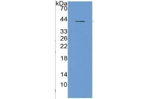 WB of Protein Standard: different control antibodies  against Highly purified E. (IGF1 Kit ELISA)