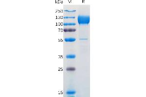 Human N Protein, hFc Tag on SDS-PAGE under reducing condition.