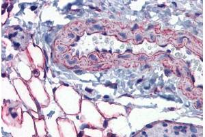 Mouse Vessel and Adipocytes: Formalin-Fixed, Paraffin-Embedded (FFPE)