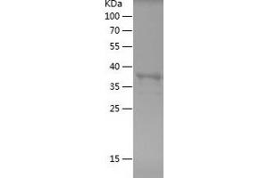 Western Blotting (WB) image for Cadherin 2 (CDH2) (AA 773-906) protein (His-IF2DI Tag) (ABIN7122074)