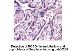 Image no. 2 for anti-Roundabout, Axon Guidance Receptor, Homolog 4 (ROBO4) (AA 200-300), (Internal Region) antibody (ABIN363597) (ROBO4 anticorps  (Internal Region))