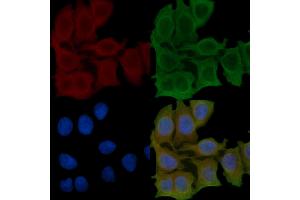 ABIN6257067 and ABIN6275524 staining Hela cells(45 min of heat-shock) by IF/ICC. (Septin 7 anticorps  (C-Term))