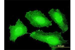 Immunofluorescence of monoclonal antibody to CTNNB1 on HeLa cell. (CTNNB1 anticorps  (AA 682-781))