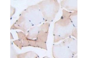 Used in DAB staining on fromalin fixed paraffin- embedded Kidney tissue (Myogenin anticorps  (AA 4-219))