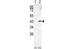 Western Blotting (WB) image for anti-Signal Peptide Peptidase 3 (SPPL3) antibody (ABIN3002611)