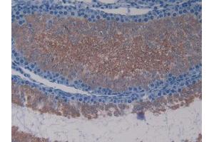 IHC-P analysis of Rat Testis Tissue, with DAB staining. (Lactate Dehydrogenase C anticorps  (AA 1-332))