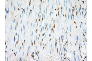 Immunohistochemical staining of paraffin-embedded colon tissue using anti-NME4 mouse monoclonal antibody. (NME4 anticorps)