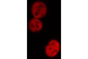 ABIN6274181 staining HeLa cells by IF/ICC. (UBTF anticorps  (Internal Region))
