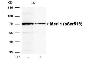 Western blot analysis of extracts from C6 cells, treated with calf intestinal phosphatase (CIP), using Merlin (Phospho-Ser518) Antibody. (Merlin anticorps  (pSer518))
