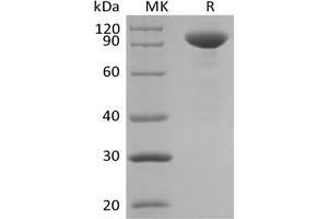 Western Blotting (WB) image for Interleukin 23 (IL23) protein (Fc Tag) (ABIN7319788) (IL23 Protein (Fc Tag))