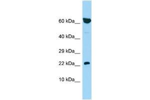 Host: Rabbit Target Name: PBOV1 Sample Type: 721_B Whole Cell lysates Antibody Dilution: 1. (PBOV1 anticorps  (N-Term))