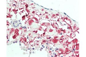 Anti-Osteoglycin / Mimecan antibody IHC staining of human lung, pleura. (OGN anticorps  (AA 246-276))