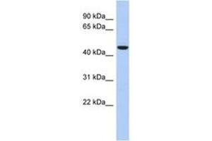 Image no. 1 for anti-Zinc Finger Protein 566 (ZNF566) (AA 143-192) antibody (ABIN6742647) (ZNF566 anticorps  (AA 143-192))