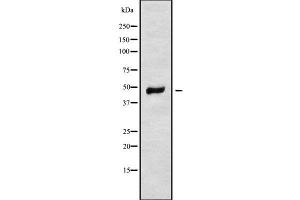 Western blot analysis of MRPS31 using HeLa whole cell lysates (MRPS31 anticorps  (Internal Region))