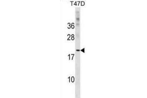 Western Blotting (WB) image for anti-C-Type Lectin Domain Family 4, Member D (CLEC4D) antibody (ABIN2999516)