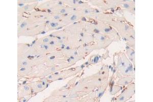 DAB staining on fromalin fixed paraffin- embedded heart tissue) (PLCE1 anticorps  (AA 1-250))