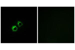 Immunofluorescence analysis of MCF-7 cells, using MRPS21 antibody. (MRPS21 anticorps  (Internal Region))