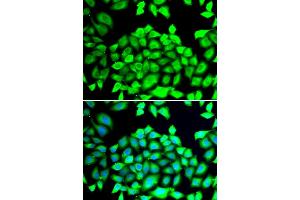 Immunofluorescence analysis of HeLa cells using CLCN7 antibody (ABIN6294018). (CLCN7 anticorps)