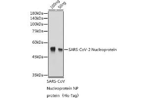 Western blot analysis of Recombinant Nucleoprotein of Coronavirus SARS-CoV-2,using SARS-CoV-2 Nucleoprotein antibody (ABIN7269053) at 1:1000 dilution. (SARS-CoV-2 Envelope anticorps)