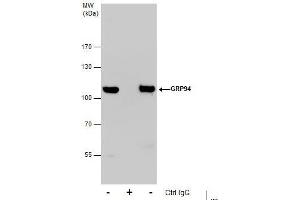 IP Image Immunoprecipitation of GRP94 protein from HeLa whole cell extracts using 5 μg of GRP94 antibody, Western blot analysis was performed using GRP94 antibody, EasyBlot anti-Rabbit IgG  was used as a secondary reagent. (GRP94 anticorps  (C-Term))