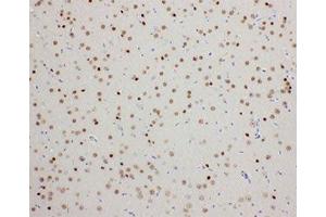 IHC-P: PDK2 antibody testing of rat brain tissue (PDK2 anticorps  (C-Term))