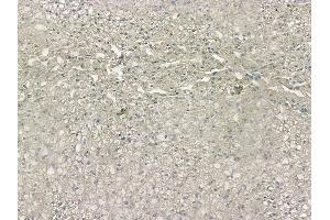 ABIN6263811 and ABIN6272373 at 1/100 staining human normal liver tissue by IHC-P.
