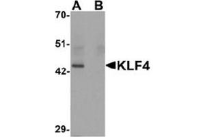 Image no. 1 for anti-Kruppel-Like Factor 4 (Gut) (KLF4) (C-Term) antibody (ABIN1449393) (KLF4 anticorps  (C-Term))